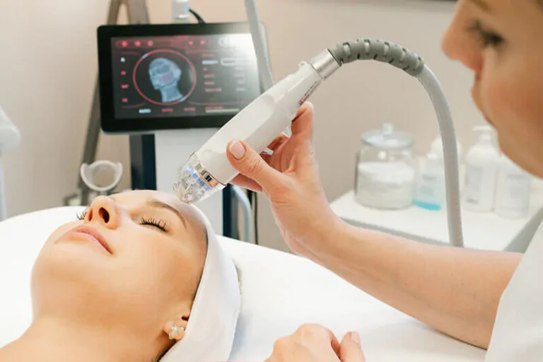 Lifting radiorefrattivo con microaghi Rf senza bisturi