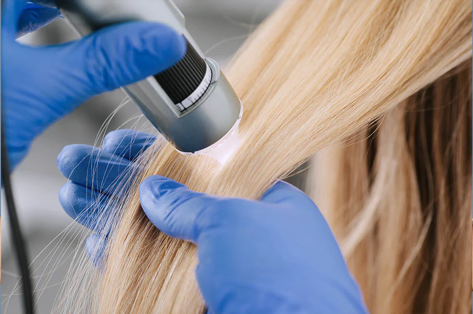 Trattamento Tricologico Vip